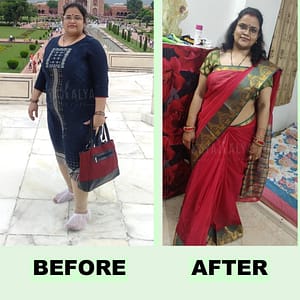 weight loss center in Udaipur, weight loss treatment in Udaipur