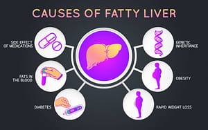 Cause of Fatty Liver